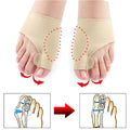 Daily Toe Aligners Toe Separator Sleeve